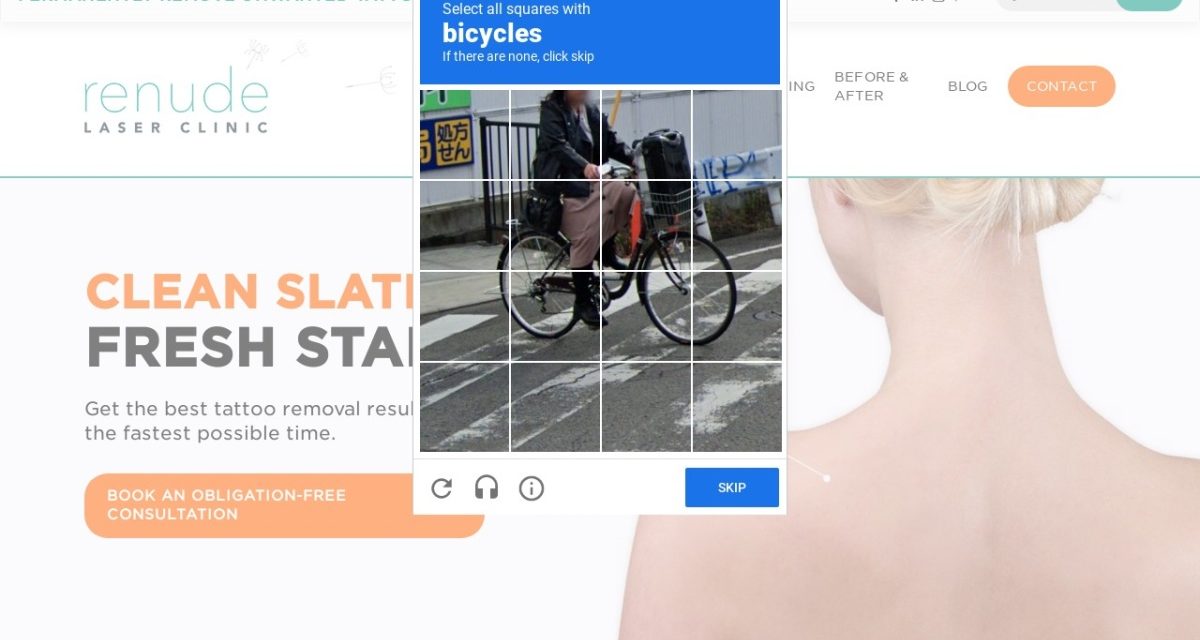 Renude Laser Tattoo Removal
