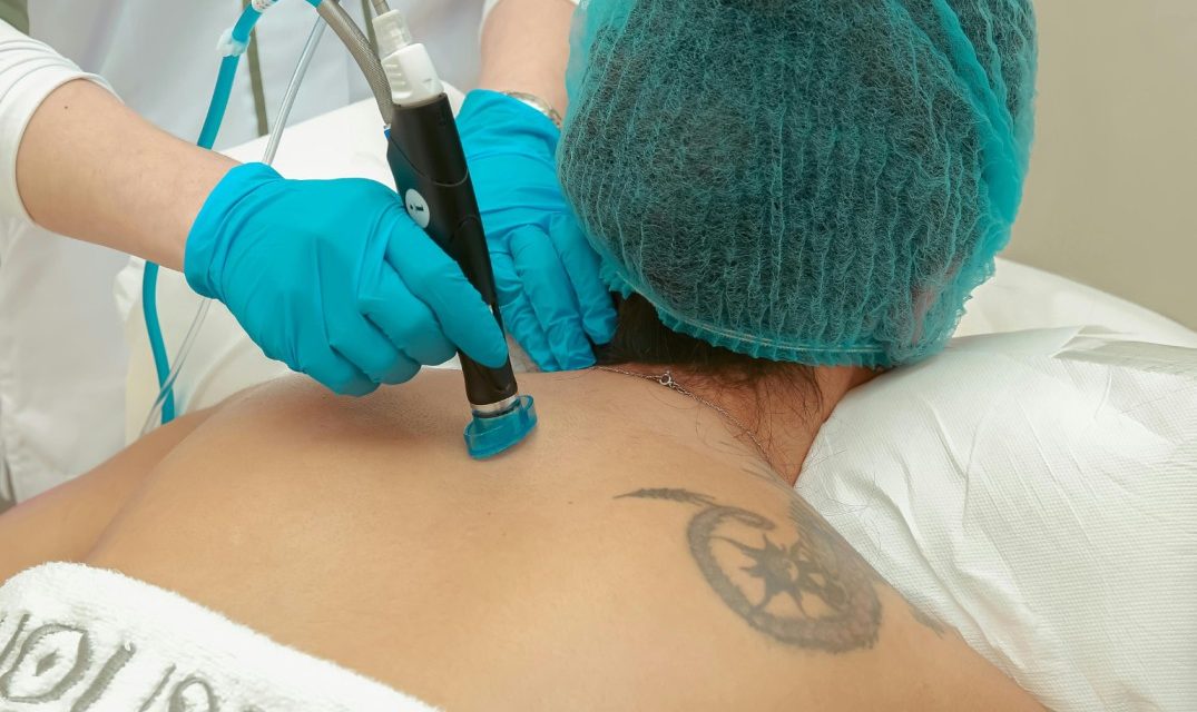 Skin Concerns You Didn’t Know Laser Can Treat