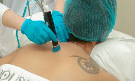 Skin Concerns You Didn’t Know Laser Can Treat