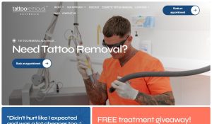 tattooremovalaus review